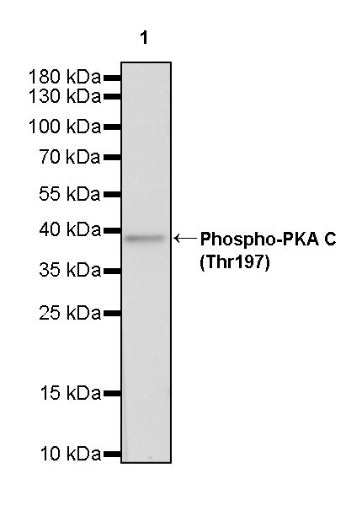 Phospho-PKA C (Thr197) Recombinant Rabbit mAb (S-1137-310)