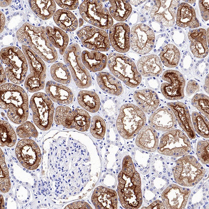 DPP4 Recombinant Rabbit mAb (S-1631-130)