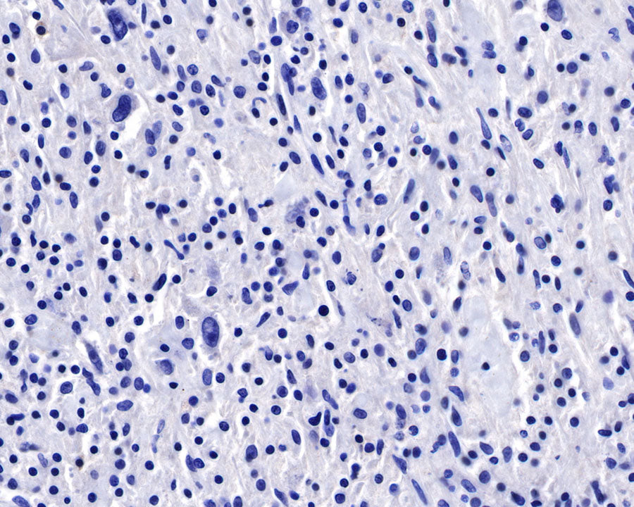 CD22 Recombinant Rabbit mAb (SDT-R113)