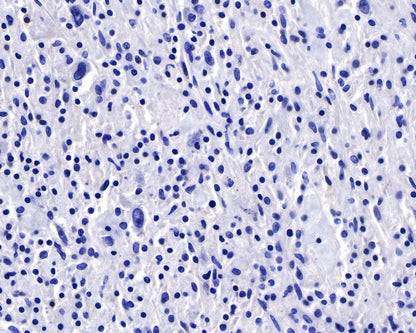 CD22 Recombinant Rabbit mAb (SDT-R113)