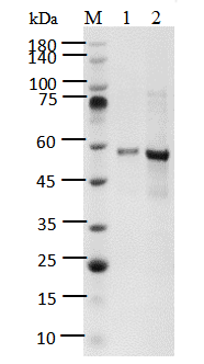 HDAC5 Protein, Human