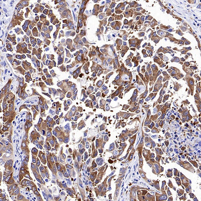 PRDM1/Blimp1 Recombinant Rabbit mAb (S-1972-3)