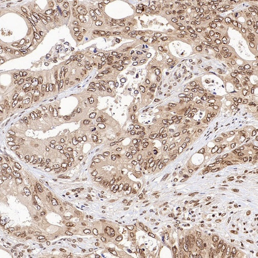 XPO1/CRM1 Recombinant Rabbit mAb (S-3309-7)