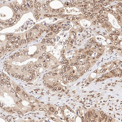 XPO1/CRM1 Recombinant Rabbit mAb (S-3309-7)