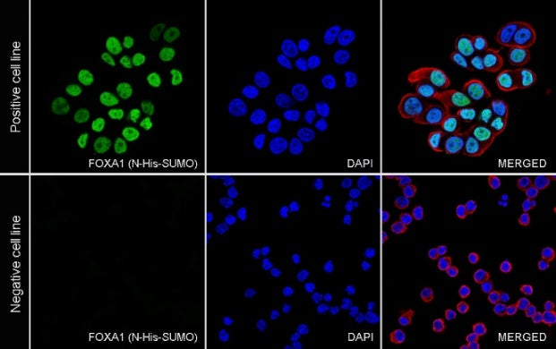 FOXA1 Recombinant Rabbit mAb (SDT-2779-17)
