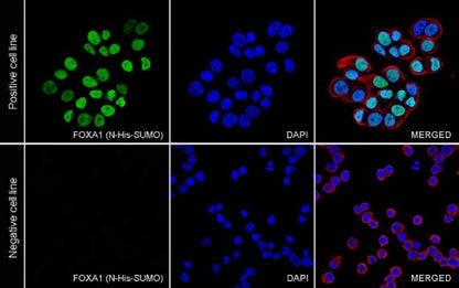 FOXA1 Recombinant Rabbit mAb (SDT-2779-17)