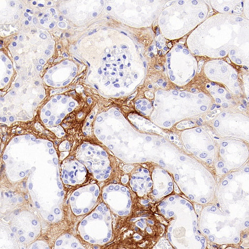 Periostin Recombinant Rabbit mAb (S-2824-17)