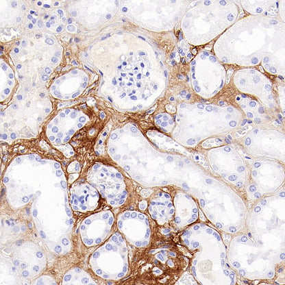 Periostin Recombinant Rabbit mAb (S-2824-17)