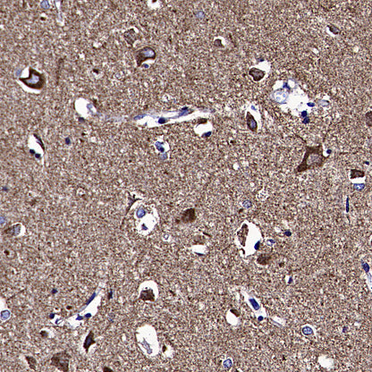 VDAC1 Recombinant Rabbit mAb (S-5314)