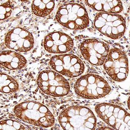 PABP Recombinant Rabbit mAb (S-1744-42)