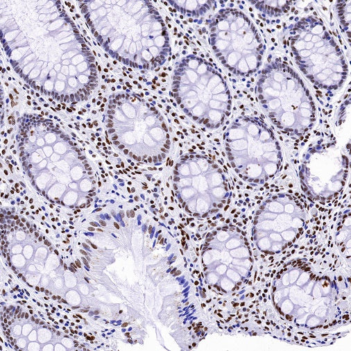 Histone H4 (acetyl K5) Recombinant Rabbit mAb (S-1464-112)
