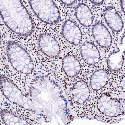 Histone H4 (acetyl K5) Recombinant Rabbit mAb (S-1464-112)