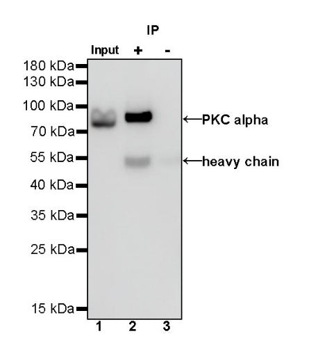 PKC alpha Recombinant Rabbit mAb (S-624-36)
