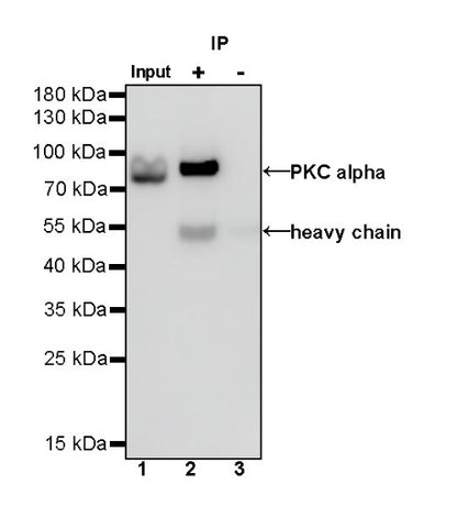 PKC alpha Recombinant Rabbit mAb (S-624-36)