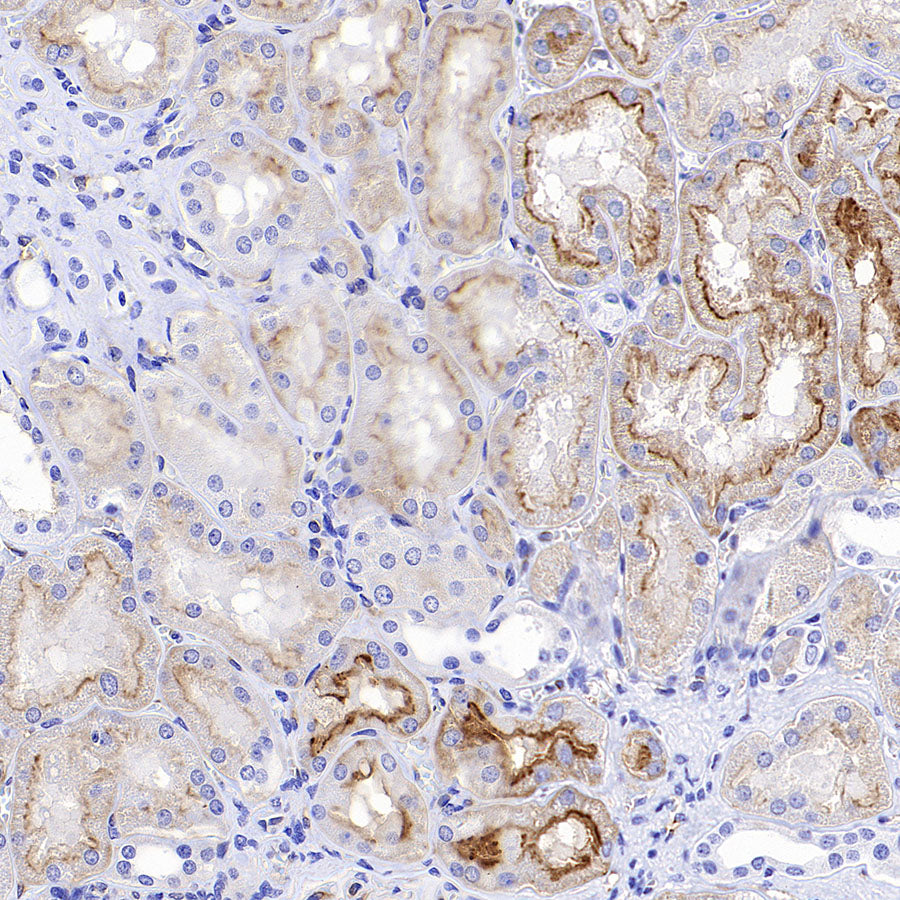 FOLR1 Recombinant Rabbit mAb (SDT-3635-124)