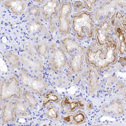 FOLR1 Recombinant Rabbit mAb (SDT-3635-124)