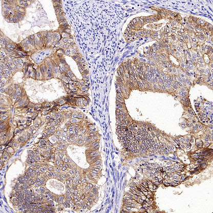 CXADR Recombinant Rabbit mAb (S-4349-1)
