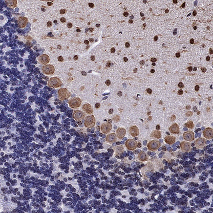Parvalbumin Recombinant Rabbit mAb (S-1620-10)