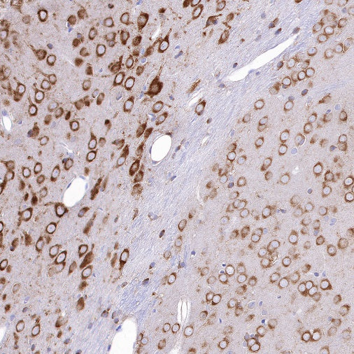 FMRP Recombinant Rabbit mAb (S-1671-1)