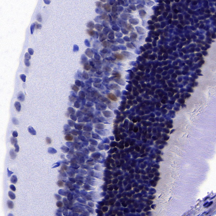 ROR beta/RORB Recombinant Rabbit mAb (S-5483)