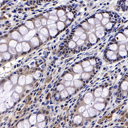 TFEB Recombinant Rabbit mAb (S-R296)