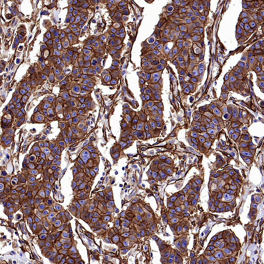 PTK7 Recombinant Rabbit mAb (SDT-2432-156)