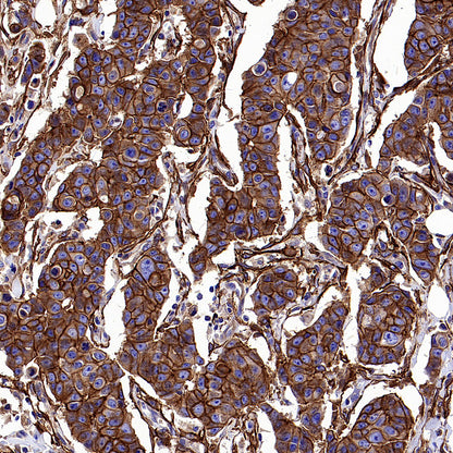PTK7 Recombinant Rabbit mAb (SDT-2432-156)