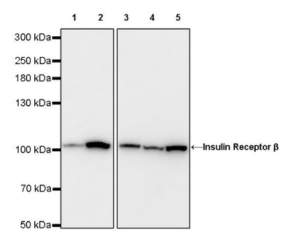 Insulin Receptor β Recombinant Rabbit mAb (S-2605-10)