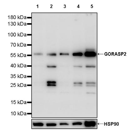 GORASP2 Recombinant Rabbit mAb (S-2526-47)
