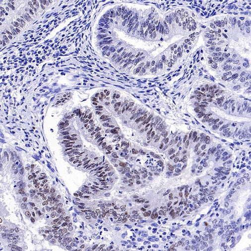 FOXC1 Recombinant Rabbit mAb (S-1607-142)