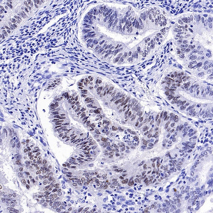 FOXC1 Recombinant Rabbit mAb (S-1607-142)