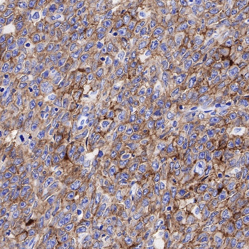 CD19 Recombinant Rabbit mAb (SDT-164-41)