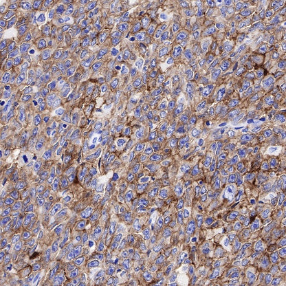 CD19 Recombinant Rabbit mAb (SDT-164-41)