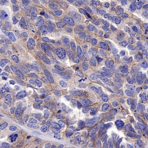 ROR1 Recombinant Rabbit mAb (SDT-R502)