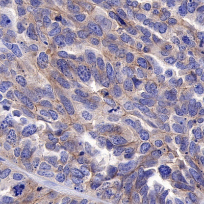 ROR1 Recombinant Rabbit mAb (SDT-R502)