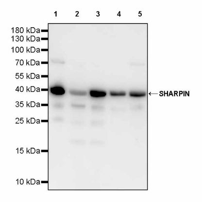 SHARPIN Recombinant Rabbit mAb (S-2356-308)