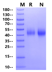 Biotinylated CEACAM-5/CD66e (499-685) His&Avi Tag Protein, Human