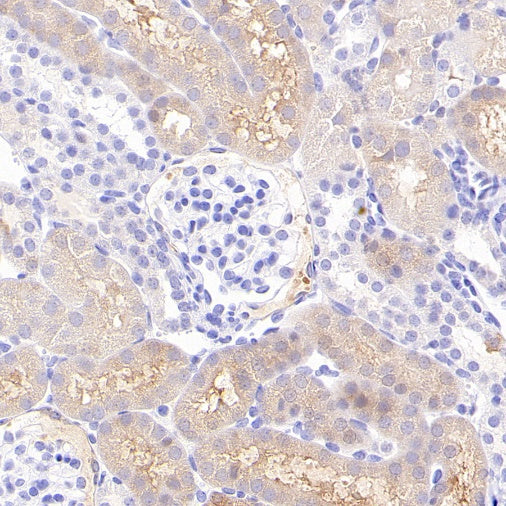 p90RSK Recombinant Rabbit mAb (S-1024-26)