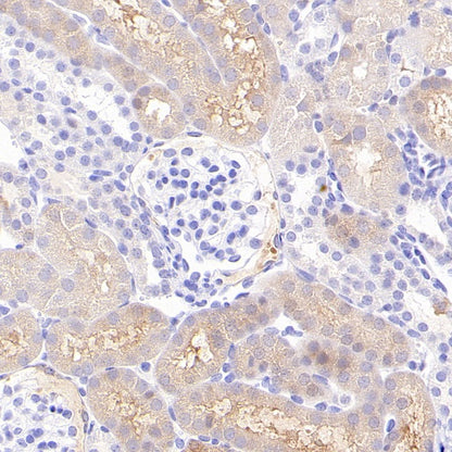 p90RSK Recombinant Rabbit mAb (S-1024-26)