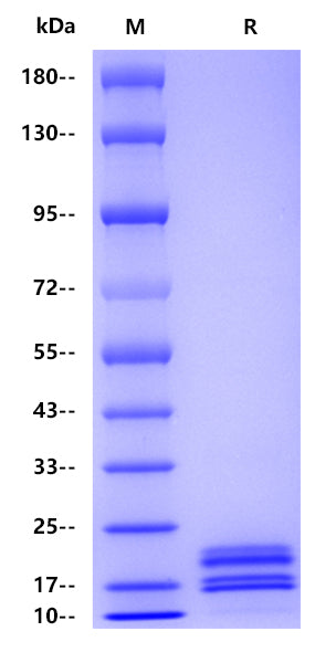 IL-17A His tag Protein, Human