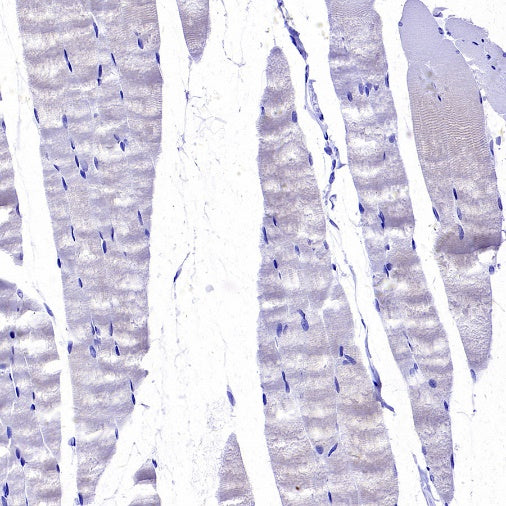 Collagen ll Recombinant Rabbit mAb (S-3360)