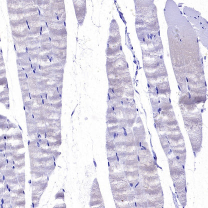 Collagen ll Recombinant Rabbit mAb (S-3360)