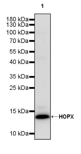 HOPX Recombinant Rabbit mAb (S-2087-269)