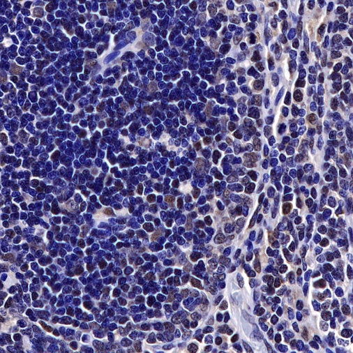 Helios Recombinant Rabbit mAb (S-1299-31)
