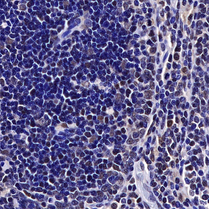 Helios Recombinant Rabbit mAb (S-1299-31)