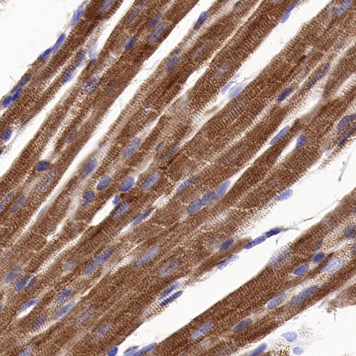 NDUFA1 Recombinant Rabbit mAb (S-1277-177)