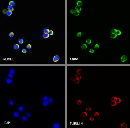 AARS1 Rabbit Polyclonal Antibody