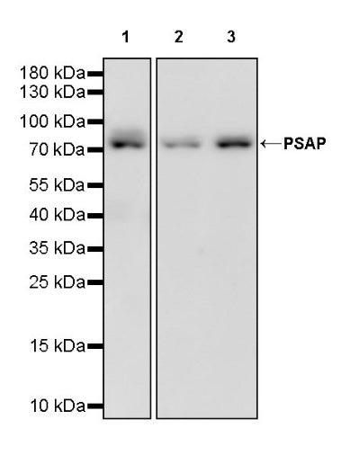 PSAP Recombinant Rabbit mAb (S-2399-11)