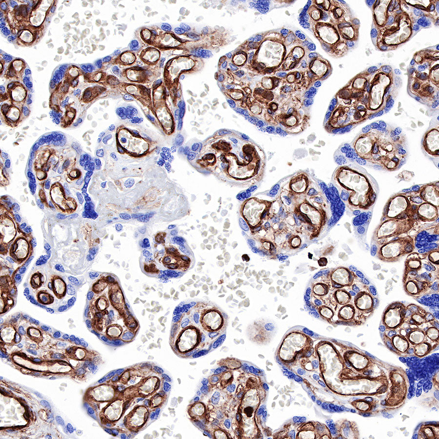 Caveolin-1 Recombinant Rabbit mAb (SDT-065-20)