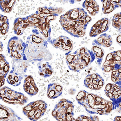 Caveolin-1 Recombinant Rabbit mAb (SDT-065-20)